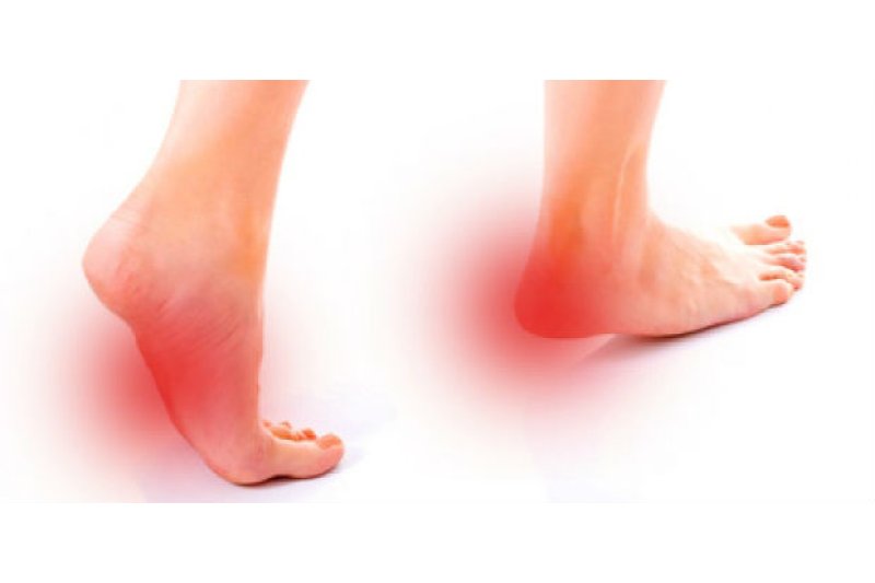 ADELA ÁLVAREZ, PODÓLOGA (*)/ Chanclas y calzado de poca sujeción o planos, aliados de la fascitis plantar y los espolones ADELA ÁLVAREZ, PODÓLOGA (*)/ Chanclas y calzado de poca sujeción o planos, aliados de la fascitis plantar y los espolones