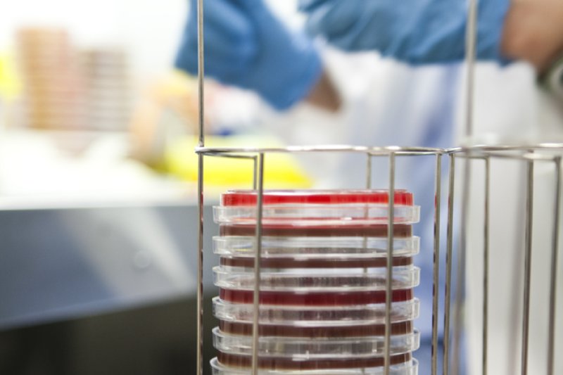 El Hospital de Dénia, centro experto en el manejo de la transfusión de sangre El Hospital de Dénia, centro experto en el manejo de la transfusión de sangre