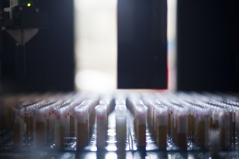 El Hospital de Dénia, centro experto en el manejo de la transfusión de sangre El Hospital de Dénia, centro experto en el manejo de la transfusión de sangre