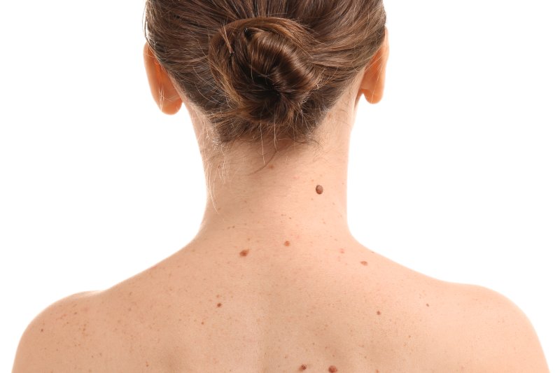 El Hospital HLA San Carlos de Denia adquiere un Dermatoscopio Digital que mejora el diagnóstico de las lesiones cutáneas El Hospital HLA San Carlos de Denia adquiere un Dermatoscopio Digital que mejora el diagnóstico de las lesiones cutáneas