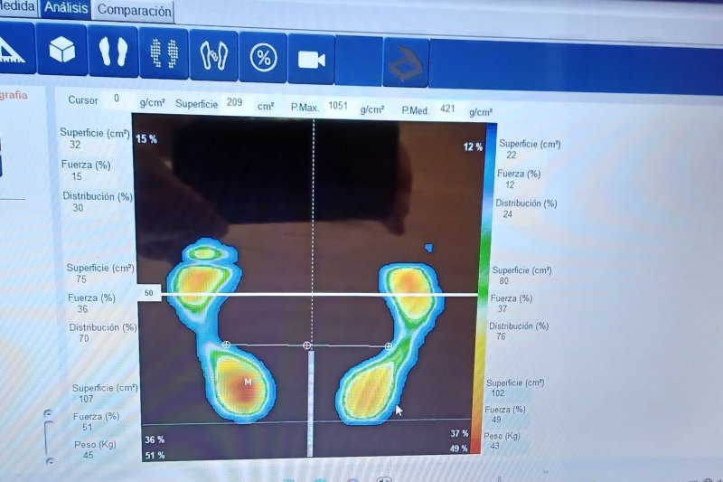 El hospital San Carlos del Grupo HLA utiliza la última tecnología para el estudio de la pisada El hospital San Carlos del Grupo HLA utiliza la última tecnología para el estudio de la pisada