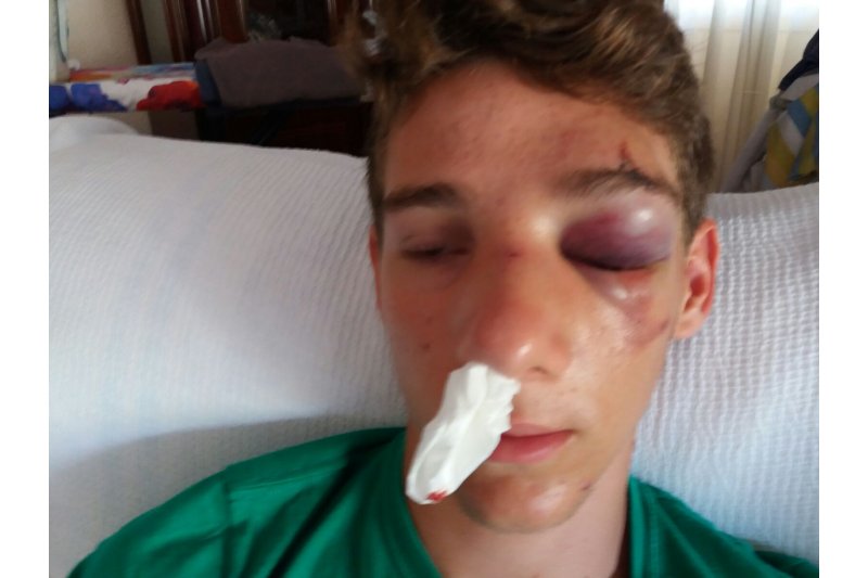 Denuncian al empleado de una empresa de patinetes acuáticos del Arenal de Xàbia por agredir a un joven de 16 años Denuncian al empleado de una empresa de patinetes acuáticos del Arenal de Xàbia por agredir a un joven de 16 años