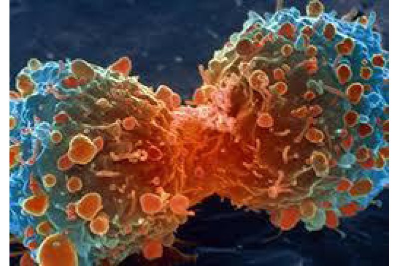 El cáncer hoy en día ya no es sinónimo de muerte El cáncer hoy en día ya no es sinónimo de muerte