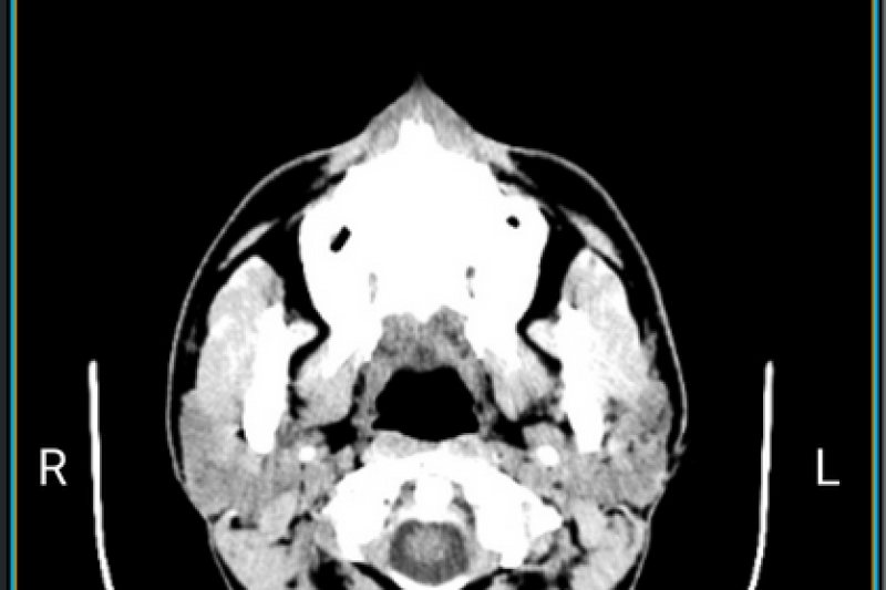 Las pruebas radiológicas ya están disponibles en la APP Mostrador Virtual de Marina Salud Las pruebas radiológicas ya están disponibles en la APP Mostrador Virtual de Marina Salud